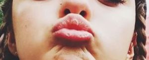 Child lips